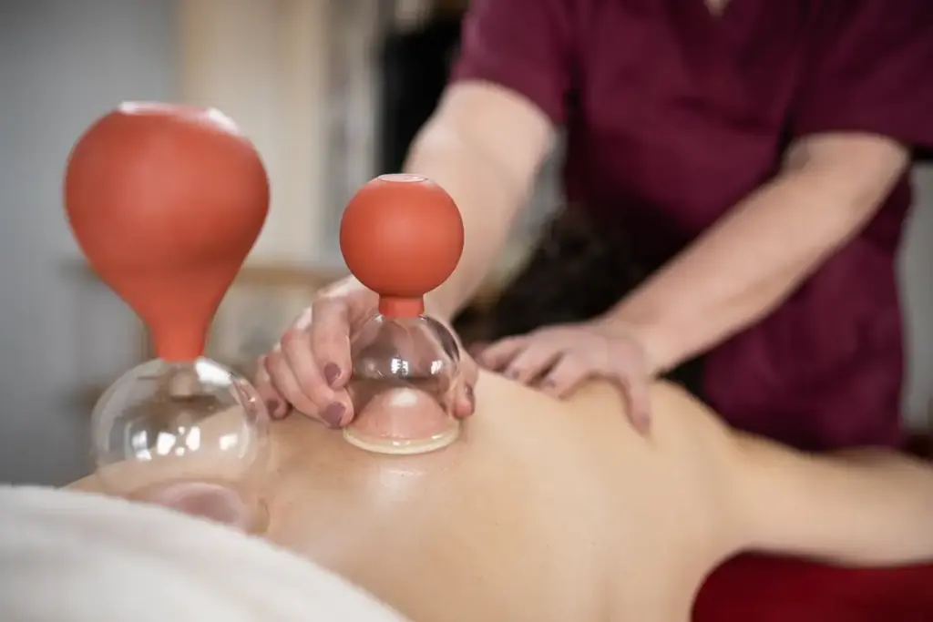 Behandlung Schröpfen